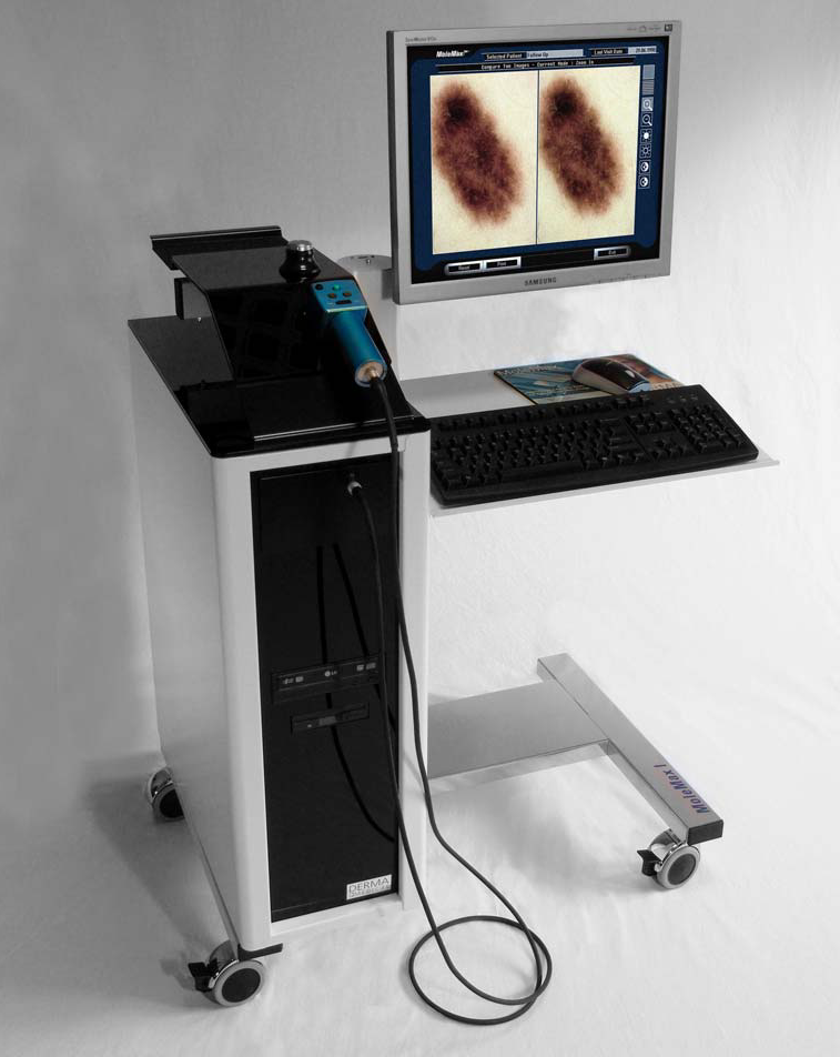 digitalny dermatoskop molemax